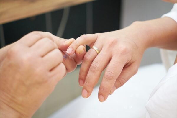 Dermatologist inspects finger brittle finger nails of a woman.